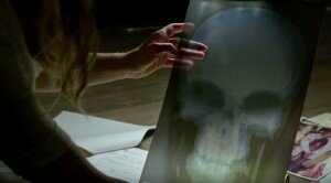 daredevil-season-2-punisher-skull-xray-pointofgeeks